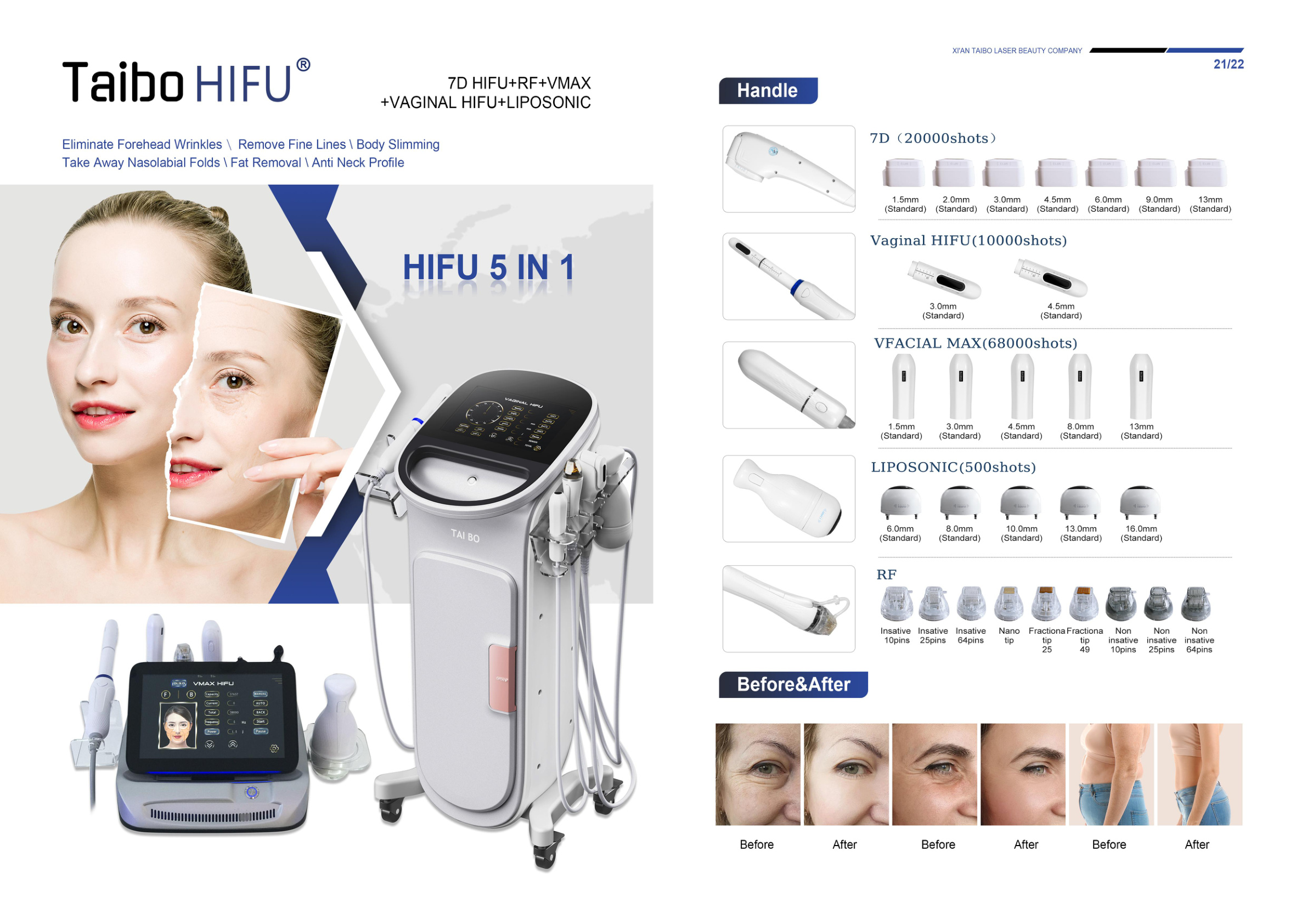 Cryolipolysis Machines
